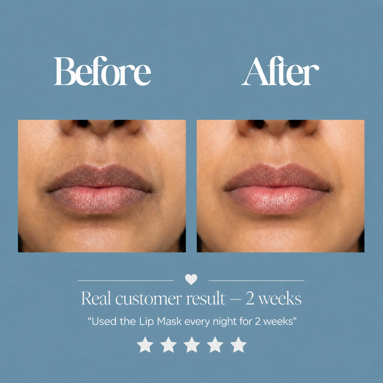 The Brightening Lip Mask